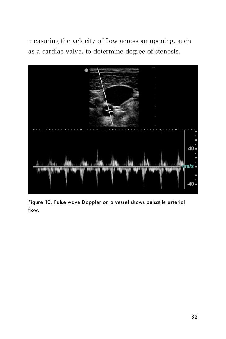 What is the USG valve, and is it worth it to muffle What is the USG valve, and is it worth it to muffle